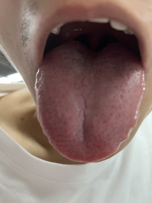 舌头.jpg