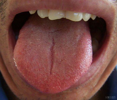 舌苔2.jpg
