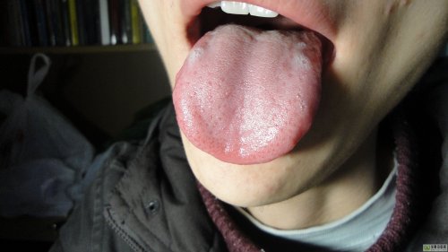 舌像.jpg