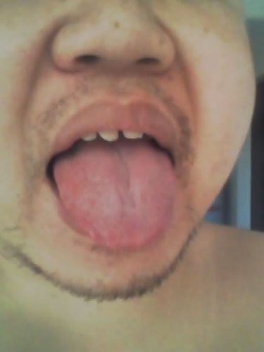 舌苔1.jpg