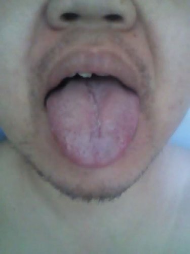 舌苔2.jpg